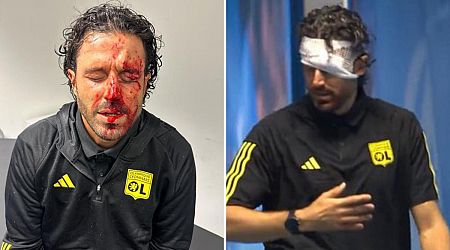 Lyon manager Fabio Grosso injured as fans attack team bus ahead of clash against Marseille