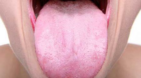 How the colour of your tongue can warn you of cancer or diabetes, according to Harvard scientists