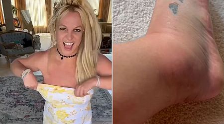 Britney Spears shows off swollen ankle and blames mother after ambulance rushed to LA hotel