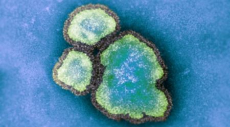 Ontario child under 5 dies of measles: provincial health agency