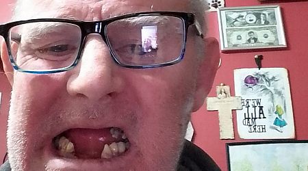 Cork man 'roaring crying' in pain claims he was forced to pull teeth with pliers due to expense of dental surgery