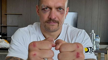 Oleksandr Usyk shows off nasty injuries from Tyson Fury fight as rematch is confirmed