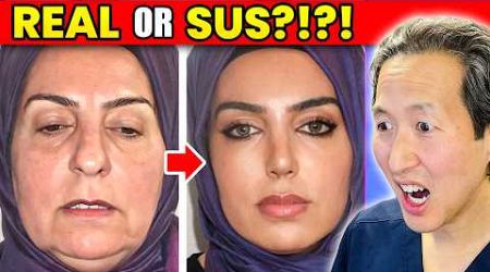 Plastic Surgeon Reacts to INSANE Turkish REAL or SUS Cosmetic Surgery Results!