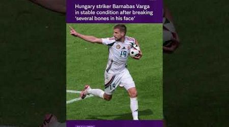 Hungary striker Barnabas Varga in stable condition after breaking &#39;several bones in his face&#39;
