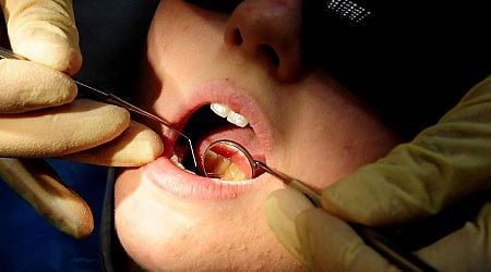 Dentist's 'Turkey teeth' decay and acid 'no turning back' warning