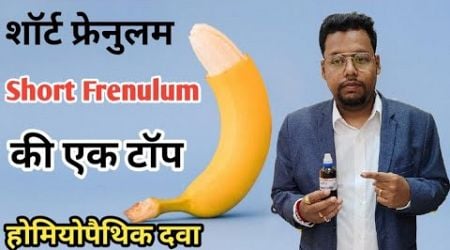 Short frenulum ki homeopathic dawa/Best Medicine for short frenulum in hindi/Short frenulum