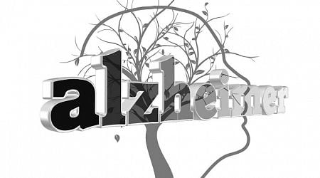 Study reveals rising Alzheimer's among working-age Finns