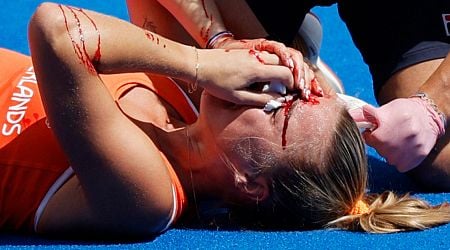 Female hockey player covered in blood after being smacked in face suffering brutal injury at Olympics 2024