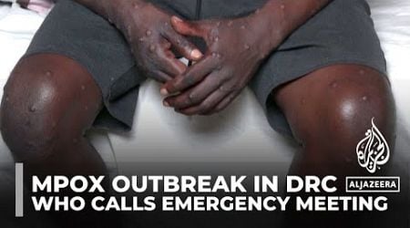 WHO calls emergency meeting to discuss jump in mpox cases from DRC