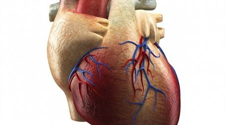 Genetic variants linked to heart rhythm disturbances in Wolff-Parkinson-White Syndrome