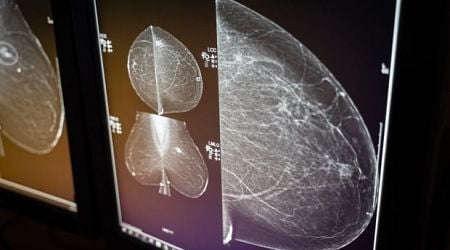 Advocates say Sask. gov't did not properly prepare to drop mammography age to 40 from 50