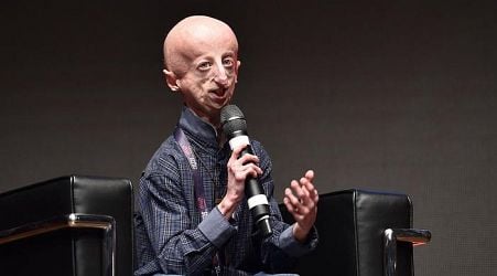 Progeria campaigner Sammy Basso dies of disease