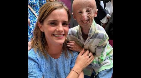 MUERE SAMMY BASSO, LA PERSONA CON PROGERIA MAS LONGEVA DEL MUNDO