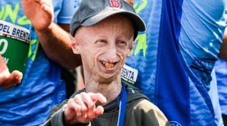 Sammy Basso Passes Away at 28: A Life Dedicated to Raising Awareness for Progeria