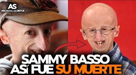 SAMMY BASSO y la Enfermedad de [ Hutchinson-Gilford ]que lo MATO _Poco A poco.