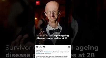 Progeria disease