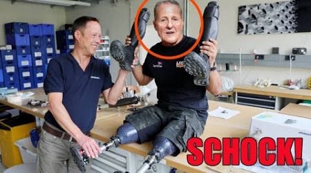 Michael Schumacher musste sich die Beine amputieren lassen, schade um ihn