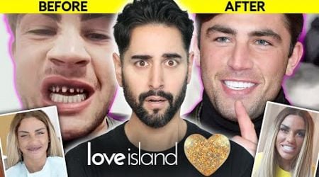 The Love Island Beauty Trend That Kills - The Dangers Of &#39;Turkey Teeth&#39; - When Beauty Turns Ugly