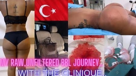 MOVIE || Come to Turkey with me to fetch my dream body ! #Bbl #surgery #southafricanyoutuber