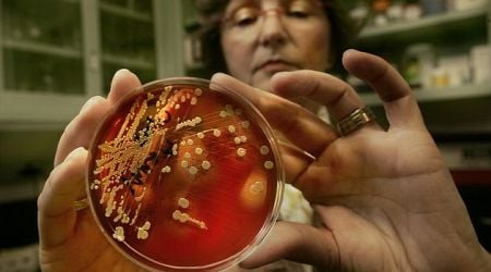 Scientists from UCD work out how MRSA superbug grows and divides despite antibiotics