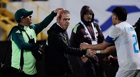 Mexico coach Aguirre hit in head by beer can after loss in Honduras