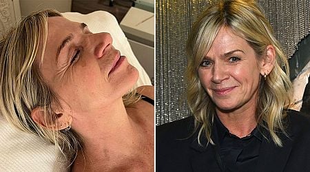 BBC Radio 2 star Zoe Ball reveals painful health condition after quitting show