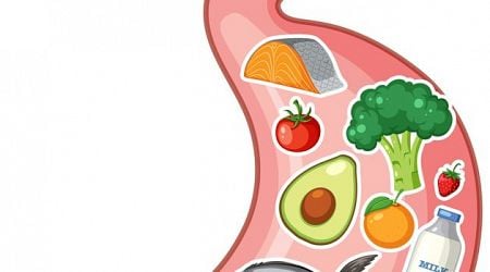 Stay Well: I suffer from IBS. What foods should I eat, and what should I avoid