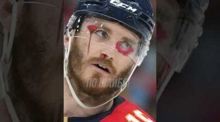 He Played Dirty, So Zack Kassian Got His Revenge!