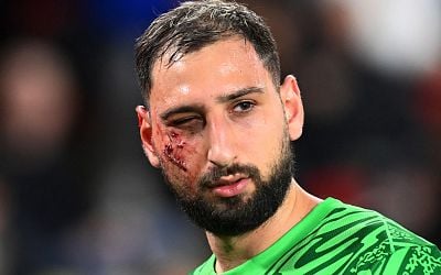 Gianluigi Donnarumma update as full extent of PSG star's gruesome injuries revealed after horror challenge