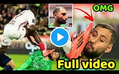 Gianluigi Donnarumma HORRIFIC FACE INJURY vs Monaco | Donnarumma injury update Donnarumma injury