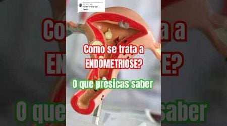 Endometriose: Como tratar e aliviar os sintomas?