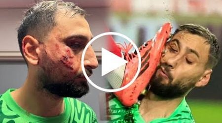 Gianluigi Donnarumma Injury | Donnarumma Injury against Monaco | Donnarumma injury update