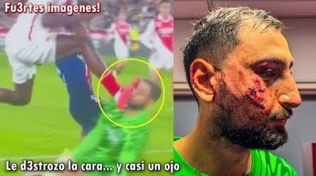 ASI FUE LA TERRIBLE LESION en la CARA a DONNARUMMA HOY