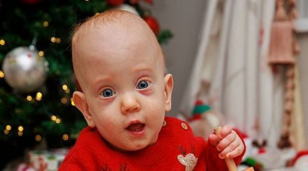 Miracle baby who weighed just 1lb 10oz set for first Christmas at home