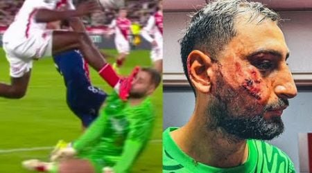 Donnarumma was seriously injured, receiving 10 stitches in his face | Psg vs Monaco |