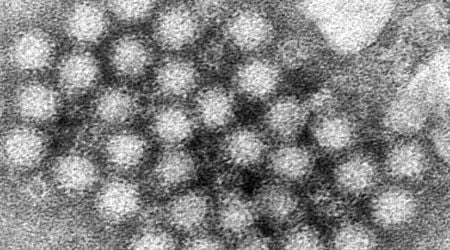 Norovirus resurgence: US stomach virus cases surging