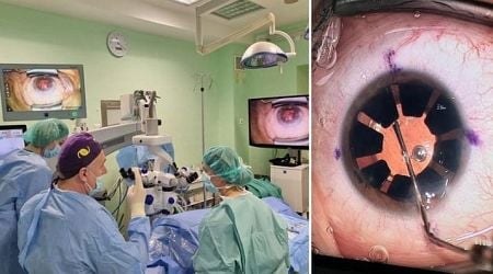 Hospital in Split implants an artificial iris for first time