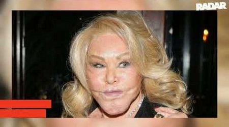 &#39;Catwoman&#39; Dead At 84: Former Billionaire Jocelyn Wildenstein Famed For Her Extreme Plastic Surgery