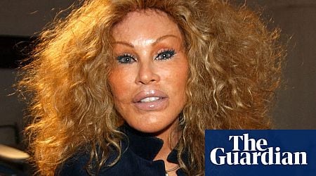 Jocelyne Wildenstein, socialite known for extreme cat-like plastic surgery, dies at 84