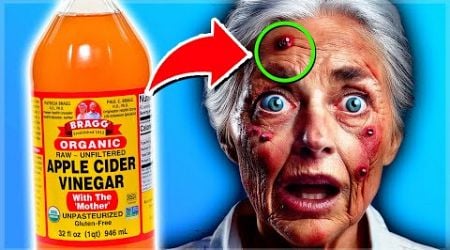 Use Apple Cider Vinegar DAILY But, NEVER Make These 3 Mistakes BEFORE BED!