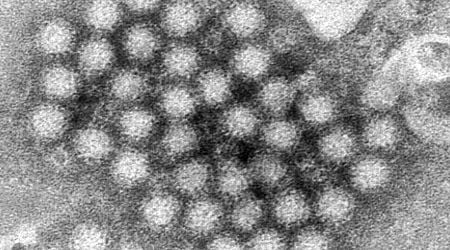 Norovirus is spiking in the US: What do we need to know?