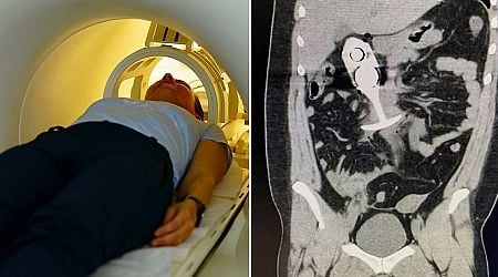 Woman writhes in agony as sex toy 'dragged through body' during intense MRI scan 