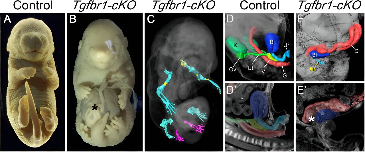 Inactivating the Tgfbr1 gene in mouse embryos results in extra limbs and no external genitals