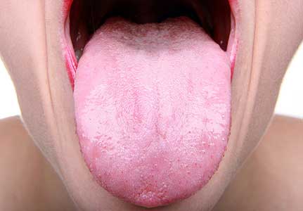 How the colour of your tongue can warn you of cancer or diabetes, according to Harvard scientists