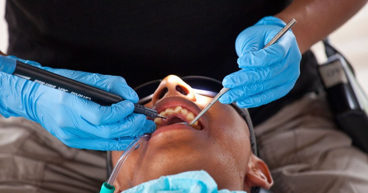 Dentist issues 'Turkey teeth' decay and acid 'no turning back' warning