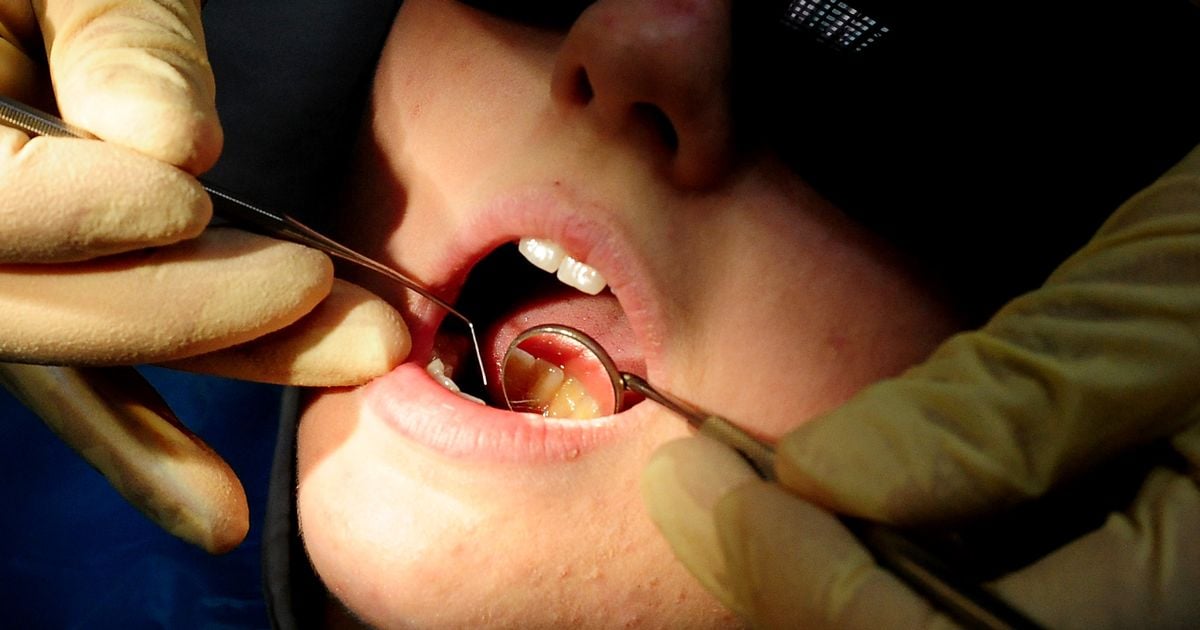 Dentist's 'Turkey teeth' decay and acid 'no turning back' warning