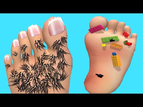 Foot Clinic - Gameplay Walkthrough - All Levels (IOS, Android)