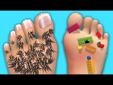 Foot Clinic - Gameplay Walkthrough - All Levels (IOS, Android)