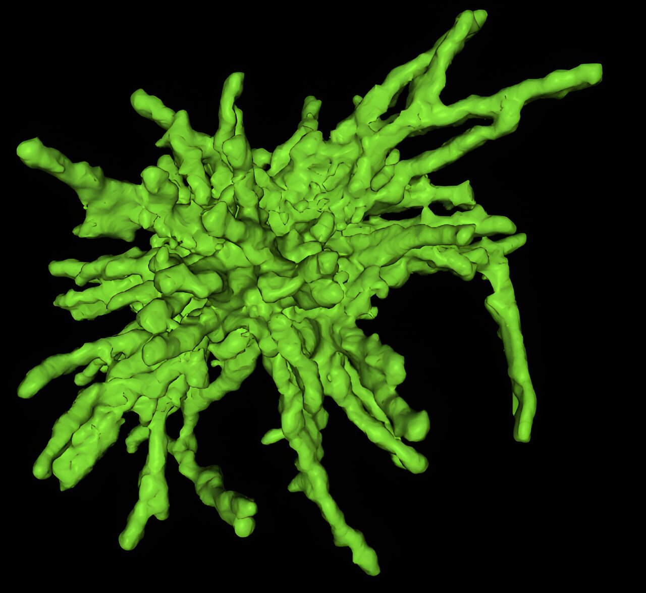 Exploring Huntington's disease: Researchers discover that protein aggregates poke holes in the nuclear membrane