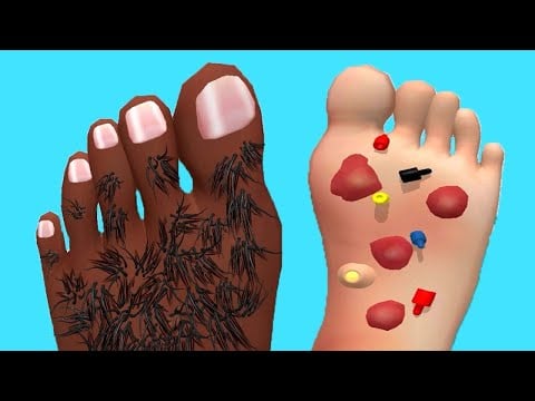 Foot Clinic - Gameplay Walkthrough - All Levels (IOS, Android)